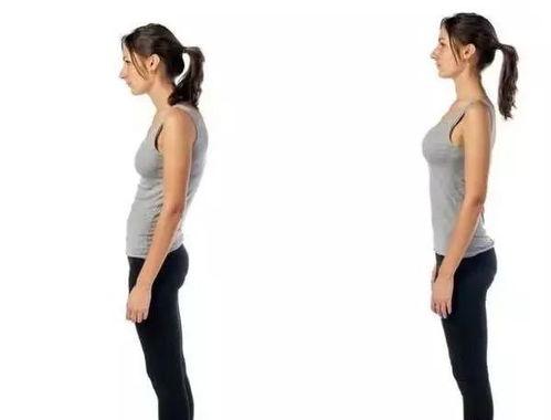 成人驼背体态改善视频讲解